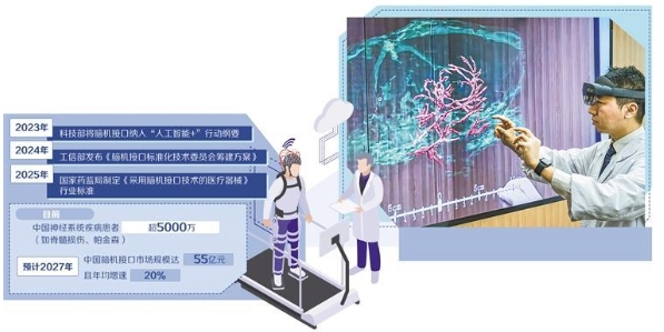 脑机接口开启产业新赛道